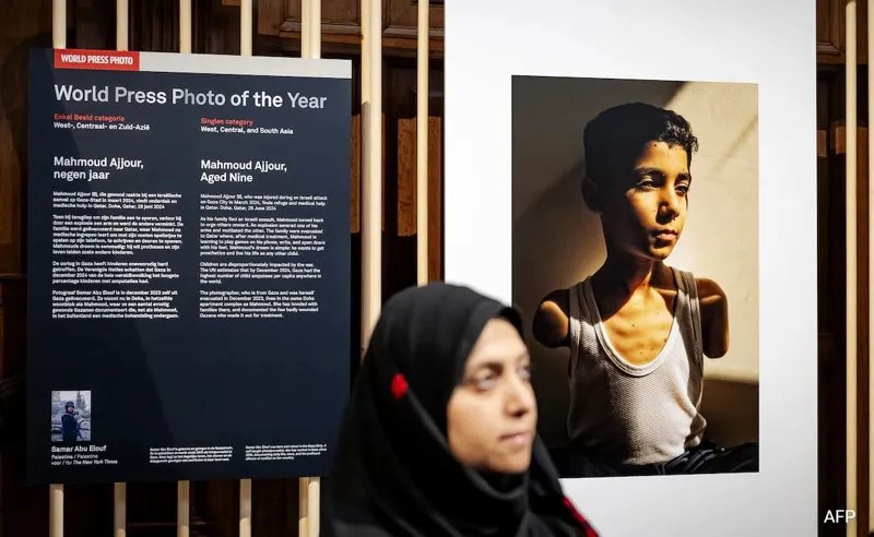 Kya baat hai! Gaza ladke ki photo ne jeet liya award!