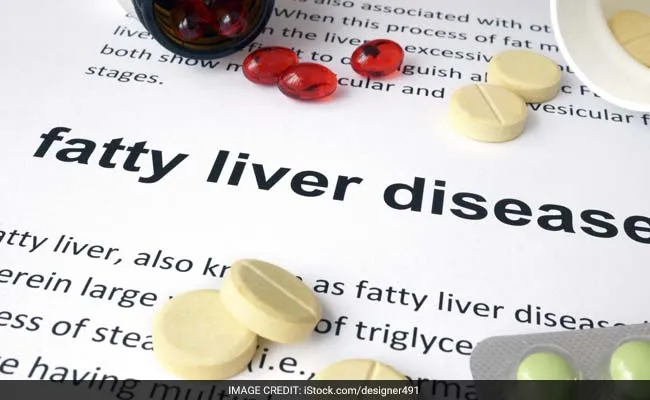8 Herbs to Manage Fatty Liver