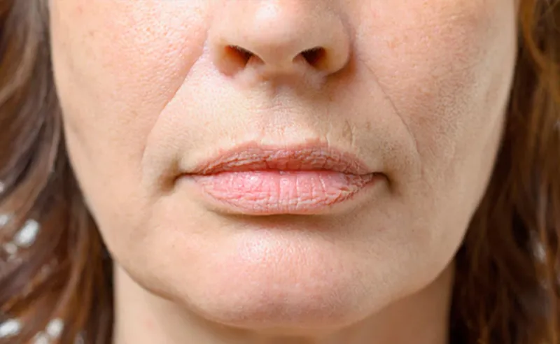 Ozempic Face & Weight Loss Risks: Latest Health News Updates