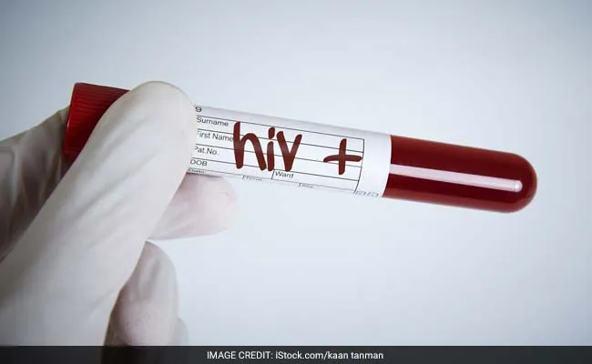 Trump ke Cuts se AIDS Program ko Khatra? Global Health Alert!